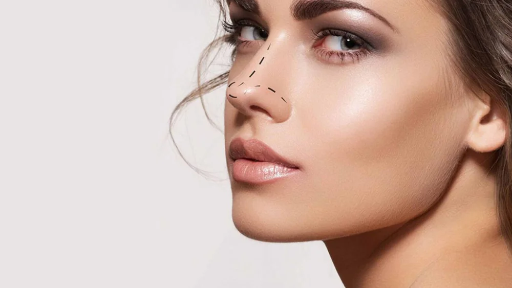 Rhinoplasty ( Nose Surgery)